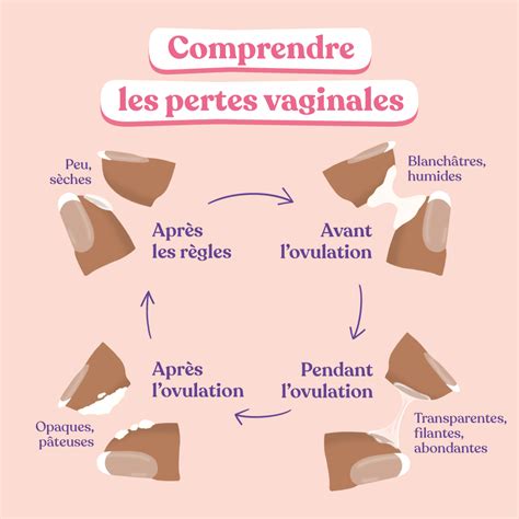 perte blanche infection|Faire la différence entre les pertes blanches, les infections et ...